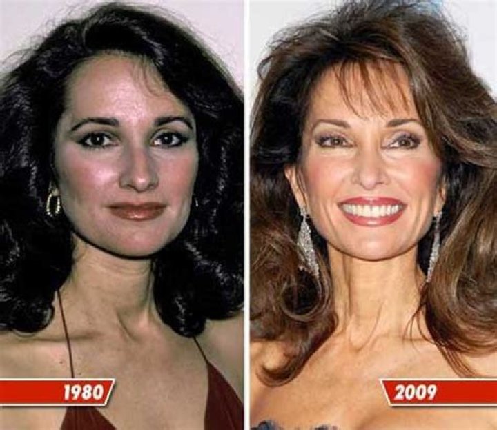 Did Susan Lucci Undergo Plastic Surgery? Who Exactly is Susan Lucci? - SarkariResult