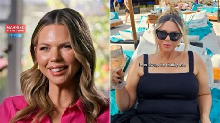 Who Is Leyna Bloom Husband Or Partner? Details On Her Before Surgery- Photos As A Child
